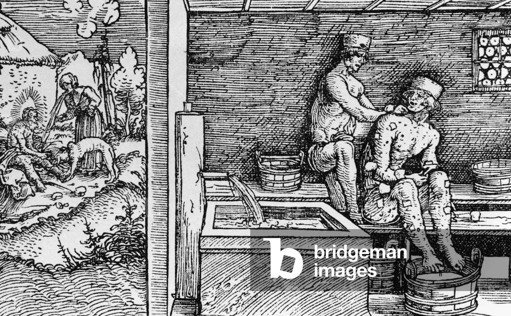 Treatment of rash, around 1510