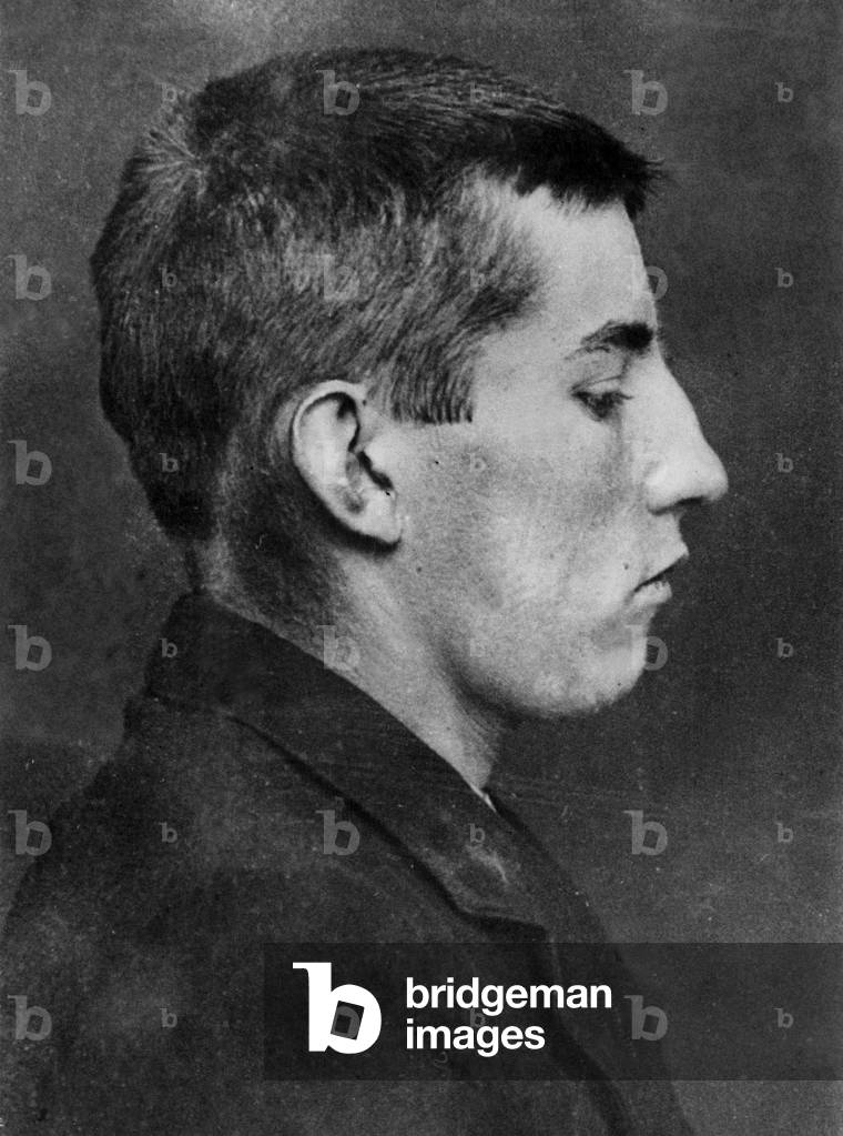 French anarchist Andre Soudy (1892-1913), member of the Bonnot's gang, here after his arrest in march 1912