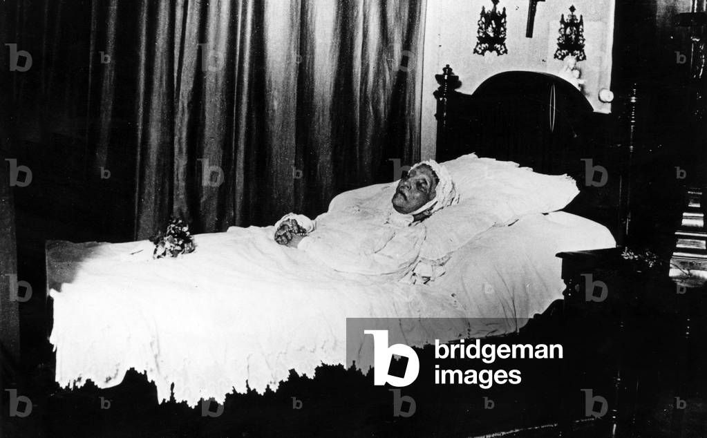 Empress Charlotte of Mexico (1840-1927), born princess of Belgium, she married Maximilian1er of Mexico (archdukeofAustria), here on her death-bed