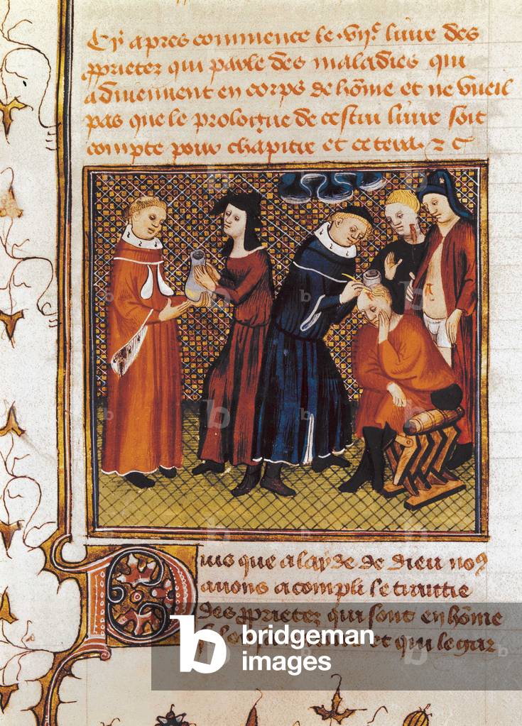 History of medicine in the Middle Ages, 14th century. Scene depicting a surgical operation of the head, a kind of cerebral removal, performed by surgeon Guy de Chauliac (1300-1368). Miniature from “The Great Surgery”, 1363. (377-000145)