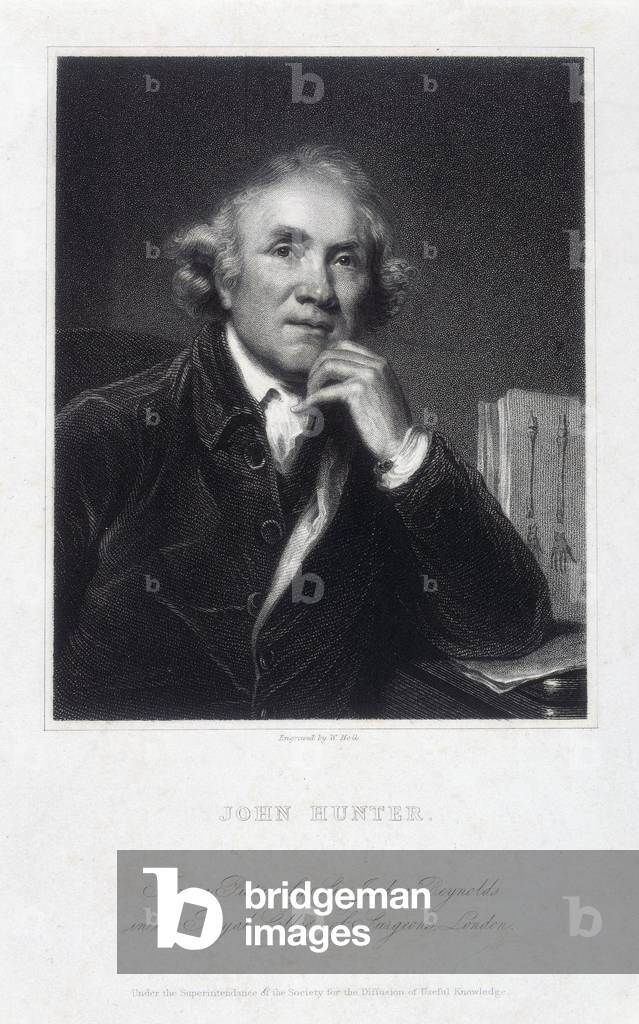 Image of John Hunter, British surgeon and anatomist, 1786