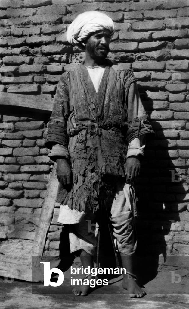 Afghanistan, An Afghan Prisoner With Legs Bound By a Metal Device, 1920-30 (b/w photo)