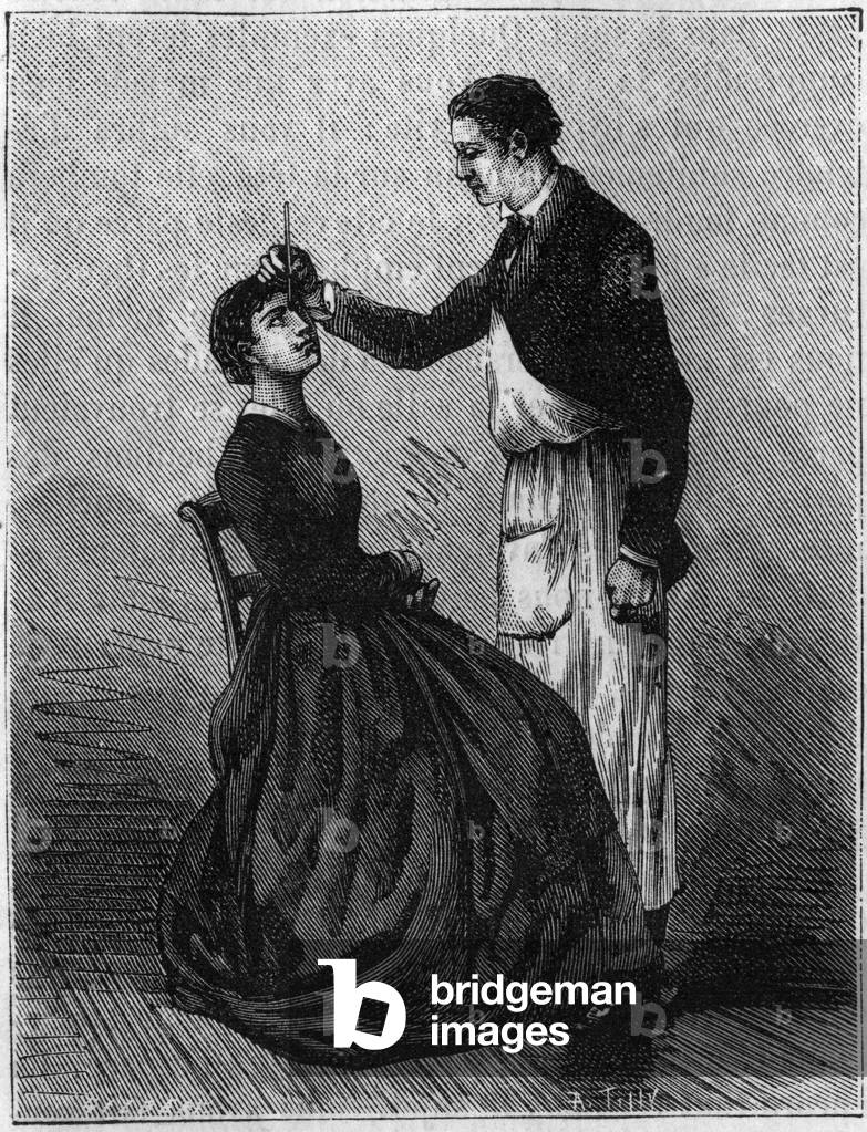 Hypnotism phenomena: Hypnotism produced by fixing a pencil holder places between the eyes. Engraving from 1881.