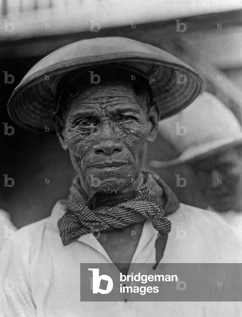 Colony of lepers in Cebu, Philippines, 40's