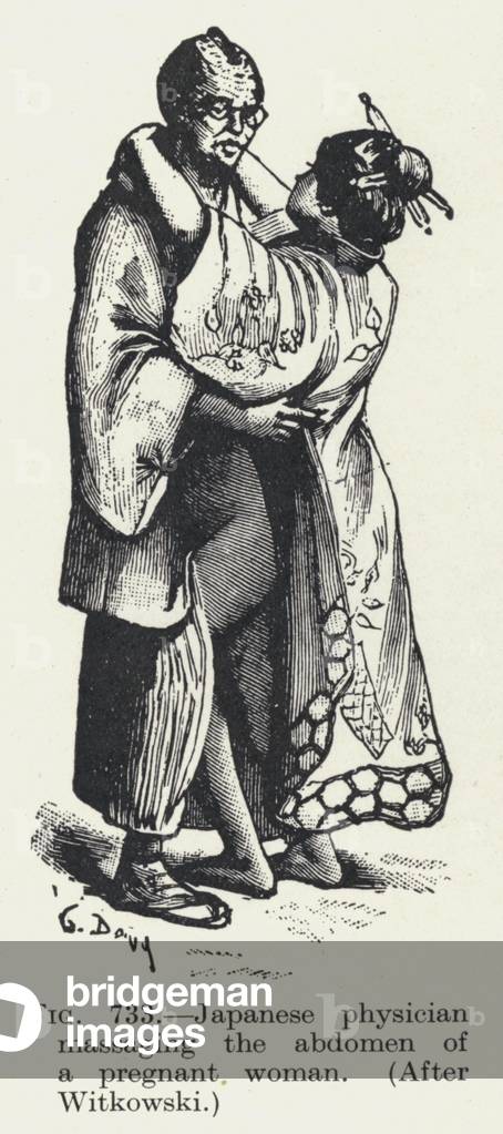 Image of Print depicting Japanese physician massaging the abdomen of a pregnant woman (litho) 1935 by English 