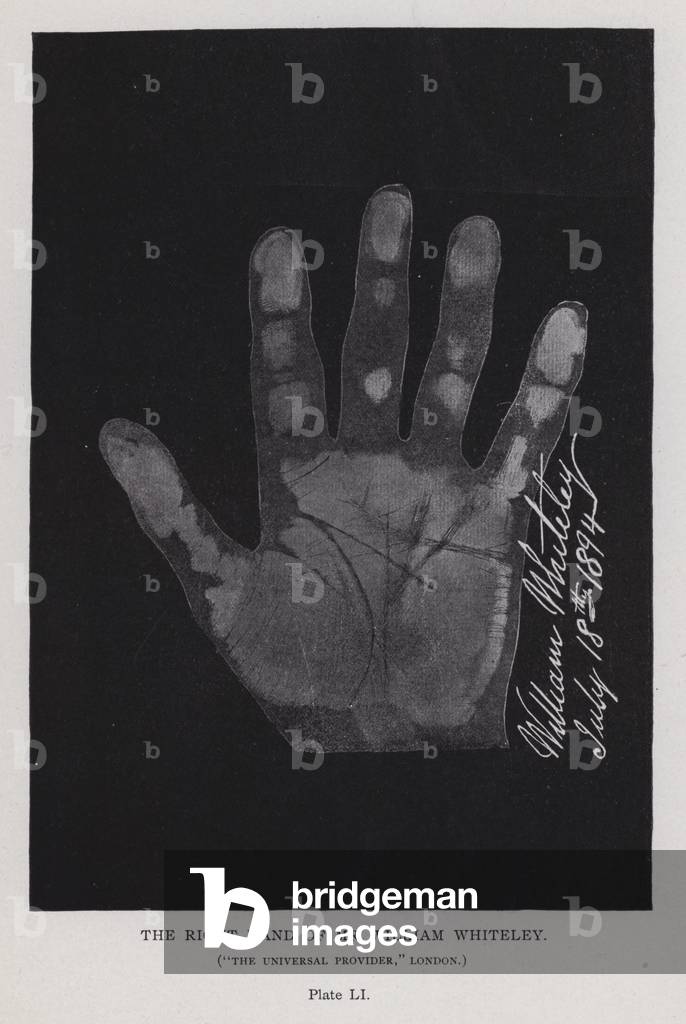 Immagine di Fotografia "La mano destra del signor William Whiteley" di English Photographer