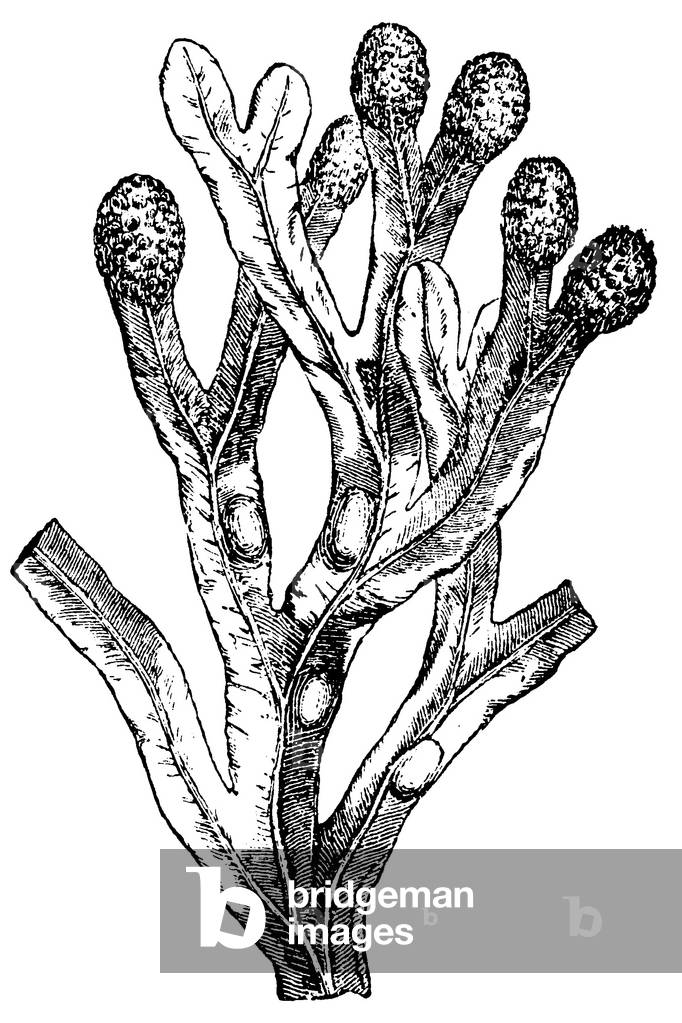 Image de Gravure représentant Fissure de la vessie, b/w