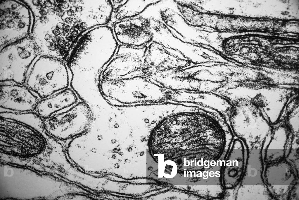 Micrographie électronique d'une colonne vertébrale dendritique, exposition Brain MIT Museum, Boston, 2021 (pho