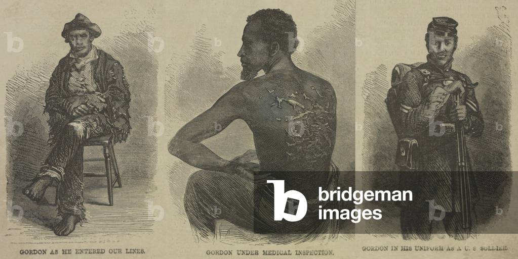 Image of Escaped slave Gordon, whose scarred back from whipping is evidence