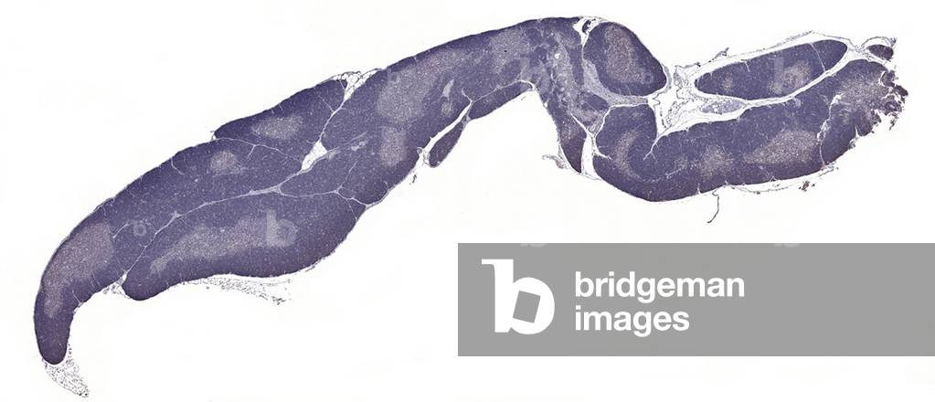 Immunoperoxidase staining of formalin-fixed, paraffin
