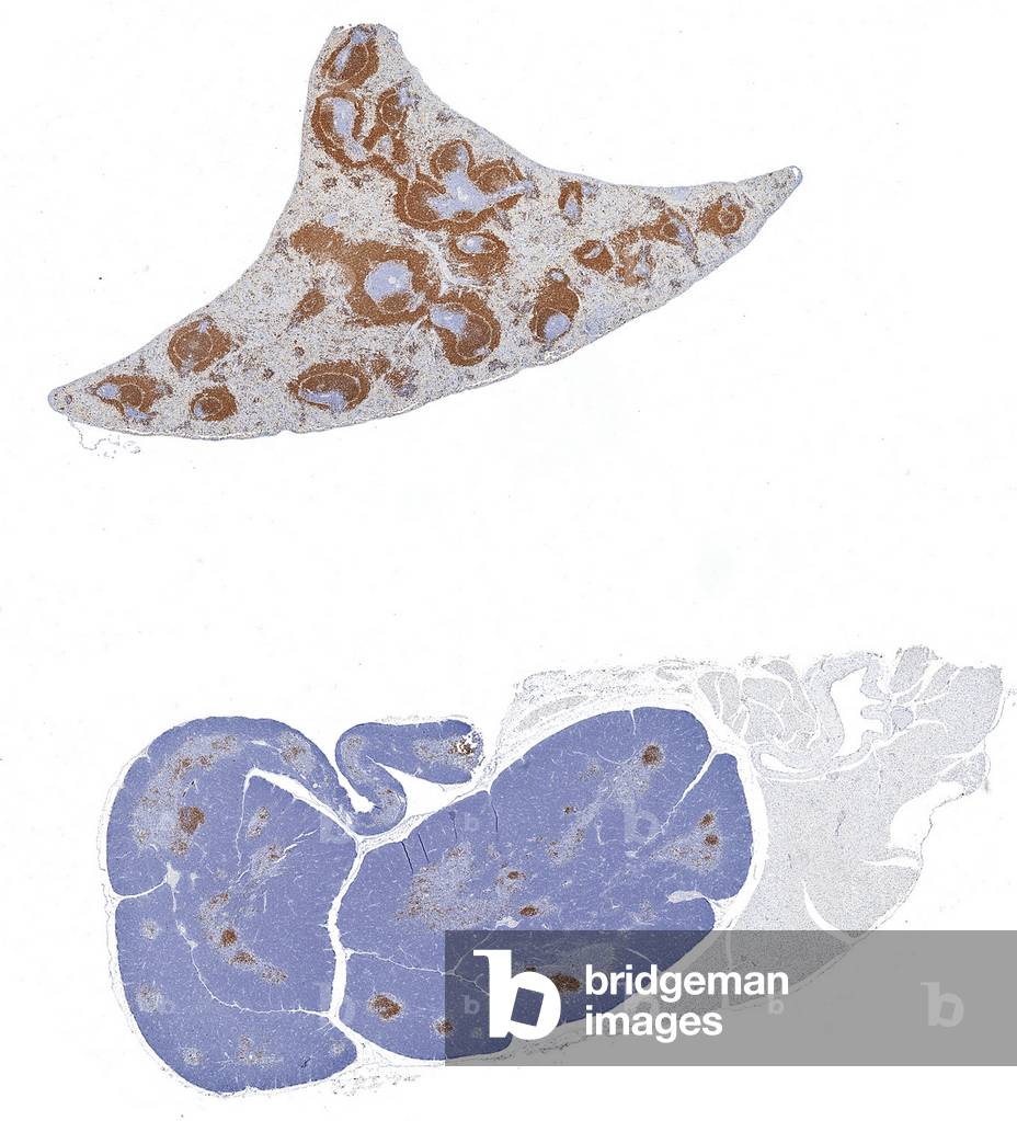 Colorazione immunoperossidasi di paraffina fissa formalina