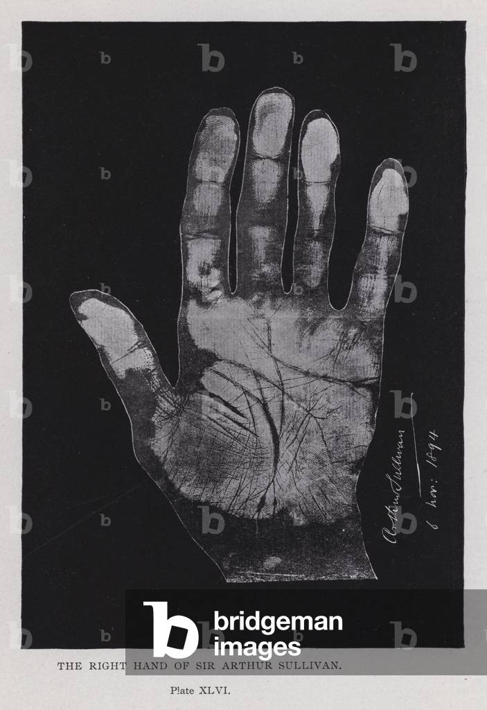 La mano destra di Sir Arthur Sullivan (foto b/n)