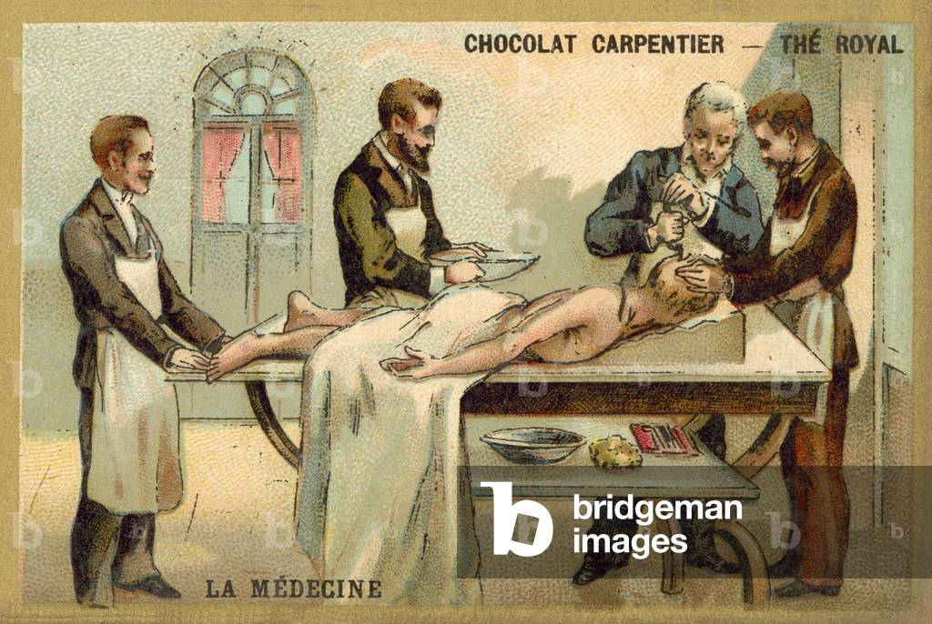 "Trepanning (cromolito)" 1801 di French School