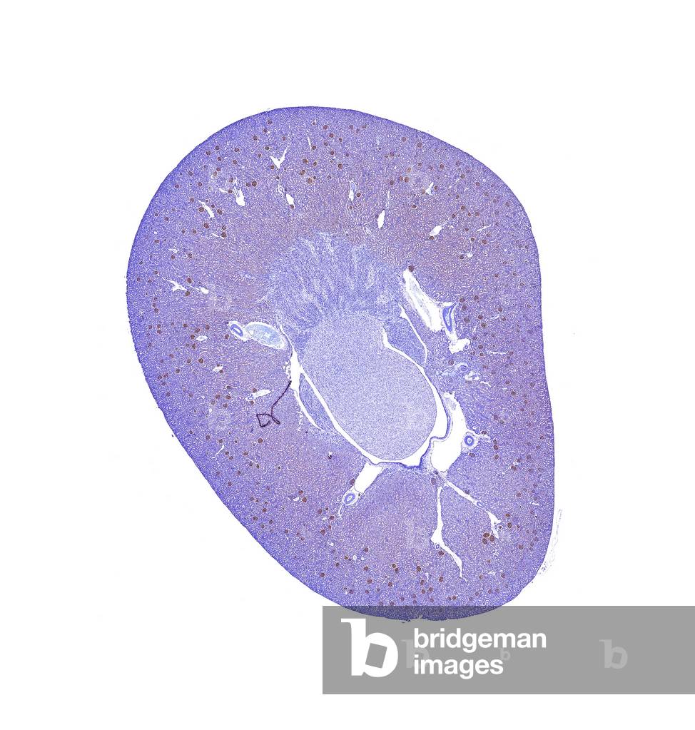Immunoperoxidase staining of formalin-fixed, paraffin