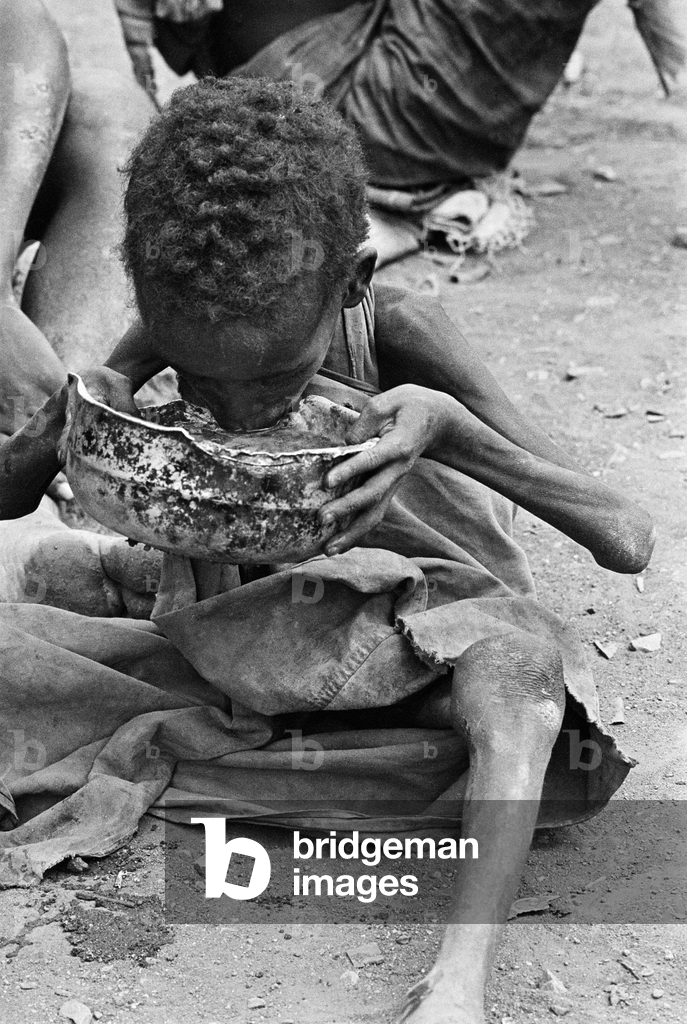 Image of Starving child fed during famine,Somalia 1991 (photo)